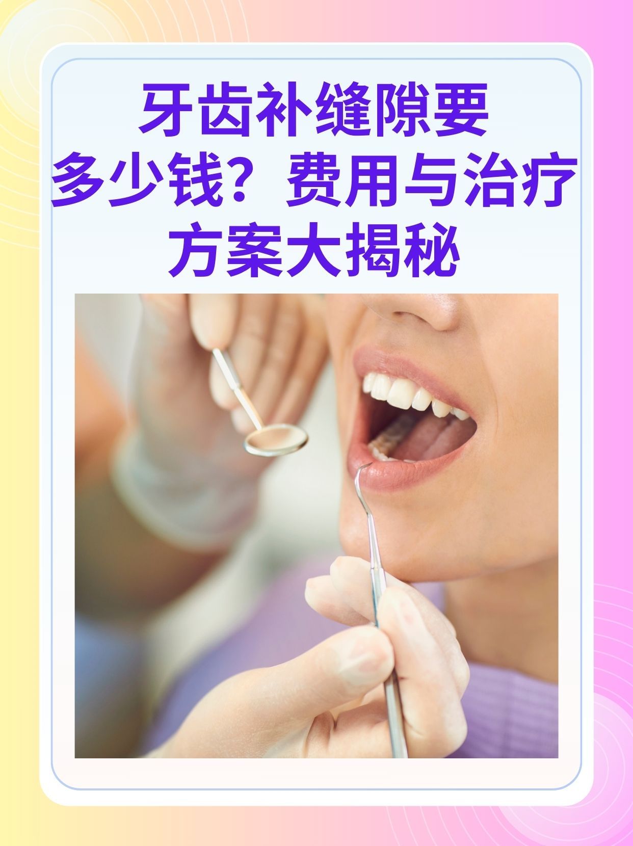 嘉峪关补牙医保可以报销吗(补牙医保可以报销吗 哪些可以报销呢)